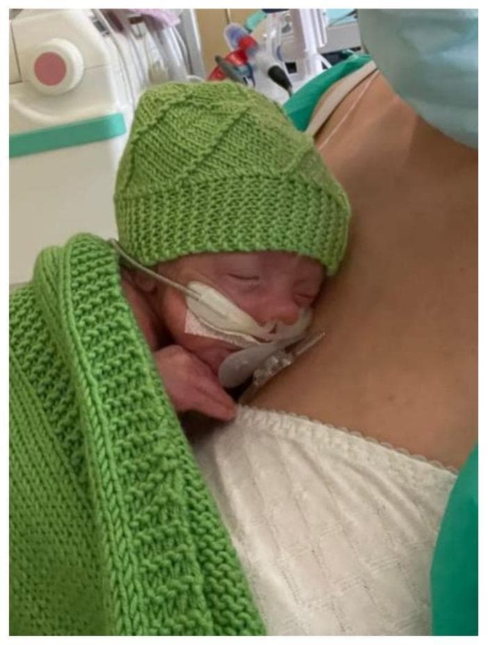 This clinical photograph illustrates a mother-infant dyad participating in a Skin-to-Skin Contact (SSC) session, also known as Kangaroo Care, within a Neonatal Intensive Care Unit (NICU) setting. The infant is positioned prone and upright in a slight 'sniffing position' against the mother’s bare chest, achieving sternum-to-sternum contact. To maintain thermoregulation, the neonate wears a light green knitted wool cap and is partially covered by a matching green knitted blanket. The infant appears to be receiving respiratory support via a nasal cannula or continuous positive airway pressure (CPAP) interface, secured with white medical tape and a stabilizing band across the face. The background shows clinical monitoring equipment and the mother wearing a white patterned top and a surgical mask, emphasizing the healthcare environment. This image serves as an educational tool for demonstrating proper positioning for SSC in stable preterm or ill infants and highlights the integration of family-centered care with medical technology for physiological stabilization.