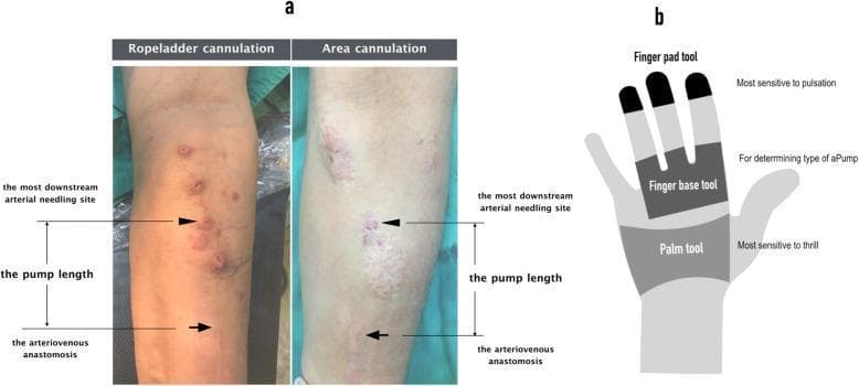 Hugging Face pmc clinical VQA raw