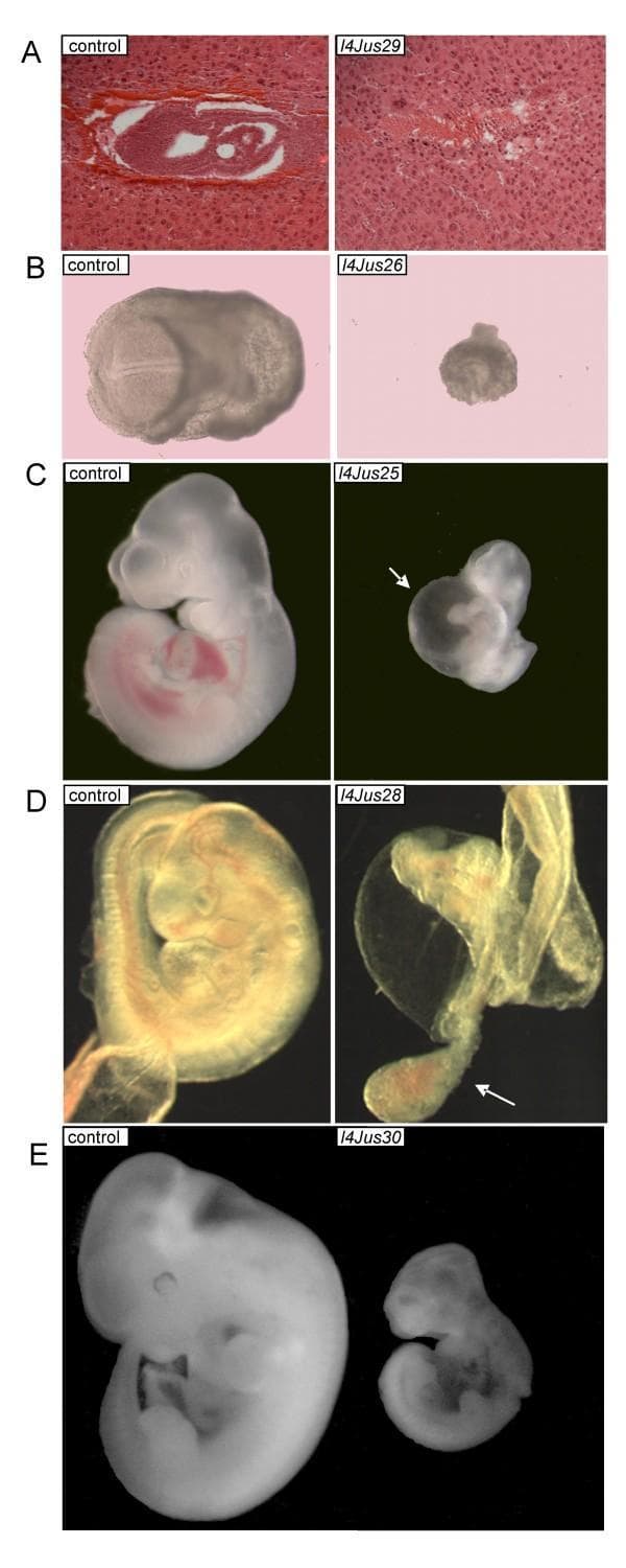 This composite educational image illustrates the phenotypic manifestations of various lethal mutations on mouse chromosome 4 (117–281) across different embryonic (E) stages. The image follows a side-by-side comparison format, with control littermates on the left and homozygous mutant embryos on the right. Panel A presents Hematoxylin and Eosin (H&E) stained histological sections at E7.5, where the l4Jus29 mutant demonstrates a failure of gastrulation. Panel B (E8.5, l4Jus26) and Panel E (E11.5, l4Jus30) show significant growth restriction and developmental delay in mutants compared to controls. Panel C (E10.5, l4Jus25) highlights cardiovascular pathology, specifically pericardial edema indicated by a white arrow. Panel D (E9.5, l4Jus28) shows a failure of embryonic turning and a defect in chorio-allantoic fusion, with a white arrow identifying the unfused allantois. This visual resource is used to teach developmental genetics, embryology, and the impact of specific chromosomal loci on organogenesis and viability.
