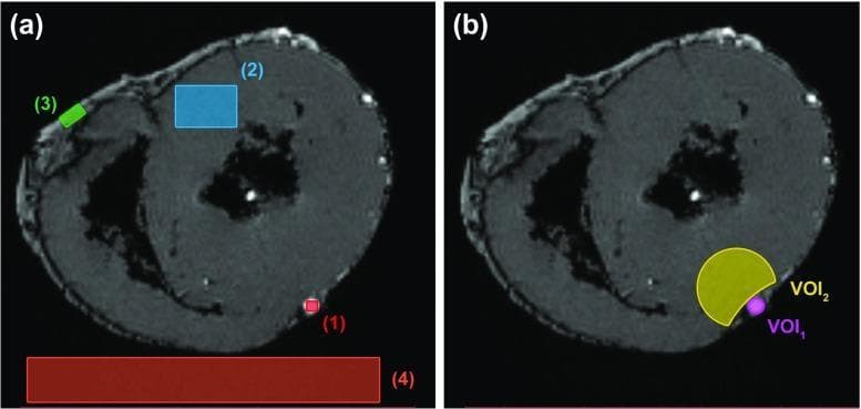 Diagnostic Magnetic Resonance Imaging (MRI) cross-sections of an ex vivo heart demonstrating quantitative analysis methods. Image (a) depicts a morphological T1-weighted scan with four labeled Regions of Interest (ROI) used for calculating signal-to-noise ratio (SNR) and contrast-to-noise ratio (CNR): ROI 1 (red square) targets the hyperintense perfusate in a vessel; ROI 2 (blue rectangle) is positioned within the mid-myocardium; ROI 3 (green rectangle) covers the epicardial fat; and ROI 4 (large red rectangle) is placed in the background to measure image noise. Image (b) shows Volumes of Interest (VOI) focused on the anterior wall: VOI 1 (violet circle) identifies the Left Anterior Descending (LAD) artery filled with contrast agent, and VOI 2 (yellow crescent) identifies the adjacent myocardium. The images serve as an educational example of how different tissue compartments (perfusate, muscle, and fat) are segmented to evaluate imaging sequences and perfusate efficacy in cardiovascular research. For orientation, the anterior cardiac wall is positioned at the bottom of the frames.