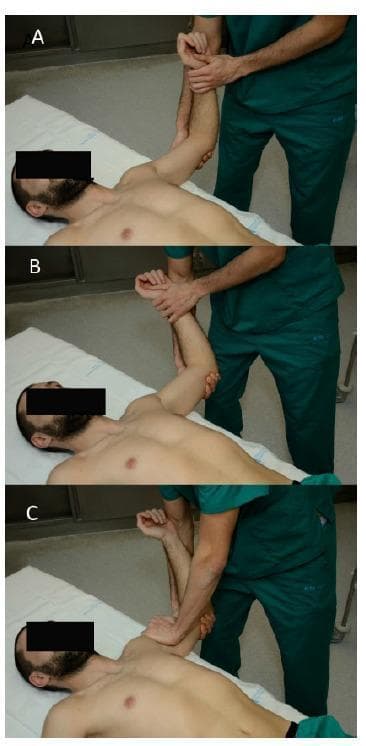 This clinical photograph series illustrates the orthopedic physical examination of the shoulder, specifically the anterior apprehension test and the relocation test. The patient is positioned supine with the right arm abducted to 90 degrees and the elbow flexed at 90 degrees. Frames A and B demonstrate the 'Apprehension Test' phase, where the examiner applies passive external rotation to the shoulder, observing for patient discomfort or a sense of impending dislocation. Frame C depicts the 'Relocation Test' (or Jobe Relocation Test), where the examiner applies a posterior-directed pressure on the anterior aspect of the humeral head while maintaining the abducted and externally rotated position. This clinical maneuver is used to evaluate anterior glenohumeral instability and labral pathology. A positive result is indicated if the posterior pressure in frame C relieves the patient's apprehension or pain experienced during frames A and B. This educational material is relevant for sports medicine and musculoskeletal assessment training.