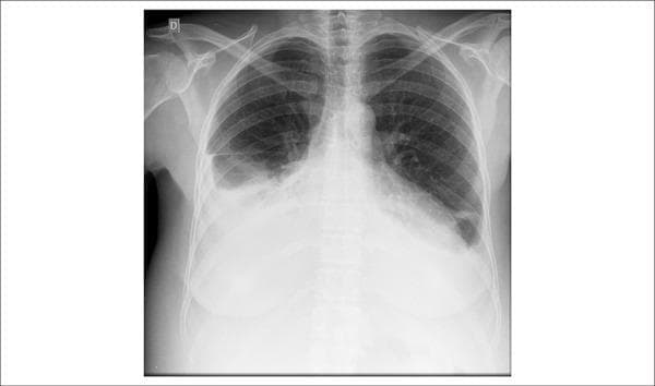 Hugging Face pmc clinical VQA raw