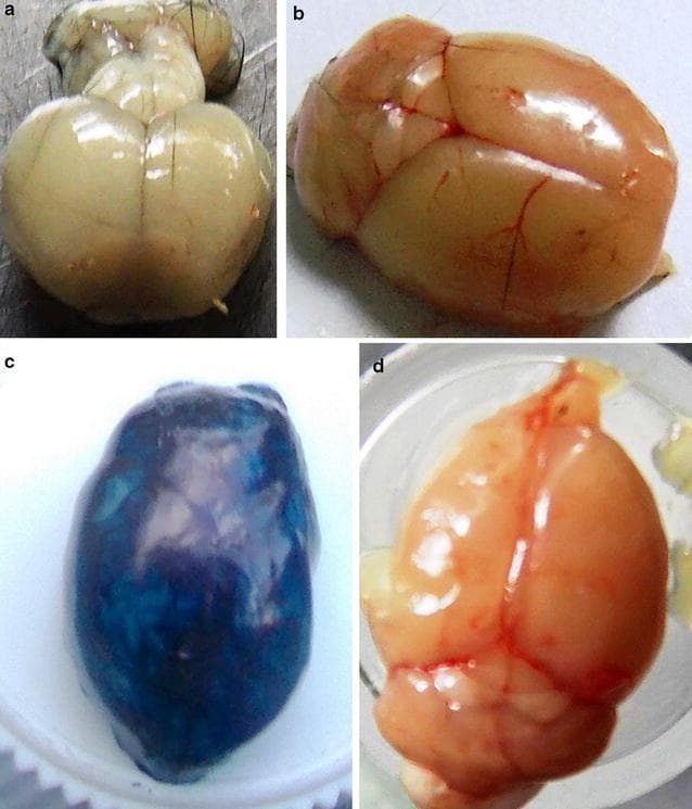 This set of clinical specimen photographs demonstrates an experimental mouse model of cerebral malaria and the evaluation of blood-brain barrier (BBB) integrity using Evans Blue dye. Image (a) shows a brain from an infected, non-stained C57BL/6 mouse exhibiting significant tissue whitening, indicative of cerebral hypoxia and reduced blood flow due to parasitized red blood cell sequestration. Image (b) presents a healthy, uninfected control brain with normal pinkish-tan coloration and visible surface vasculature, reflecting an intact BBB. Image (c) displays an infected brain after intravenous administration of Evans Blue dye; the deep blue staining of the parenchyma indicates substantial leakage of the dye through a compromised BBB, a hallmark of experimental cerebral malaria. Image (d) illustrates a brain from an infected mouse 60 days post-treatment with trioxaquine, showing a return to normal gross morphology, visible vasculature, and an absence of blue staining, confirming clinical recovery and restoration of BBB integrity. This comparison serves as an educational tool for understanding pathophysiology in neuro-parasitology and pharmacological efficacy in treating vascular neurological complications.