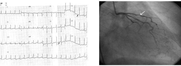 Hugging Face pmc clinical VQA raw