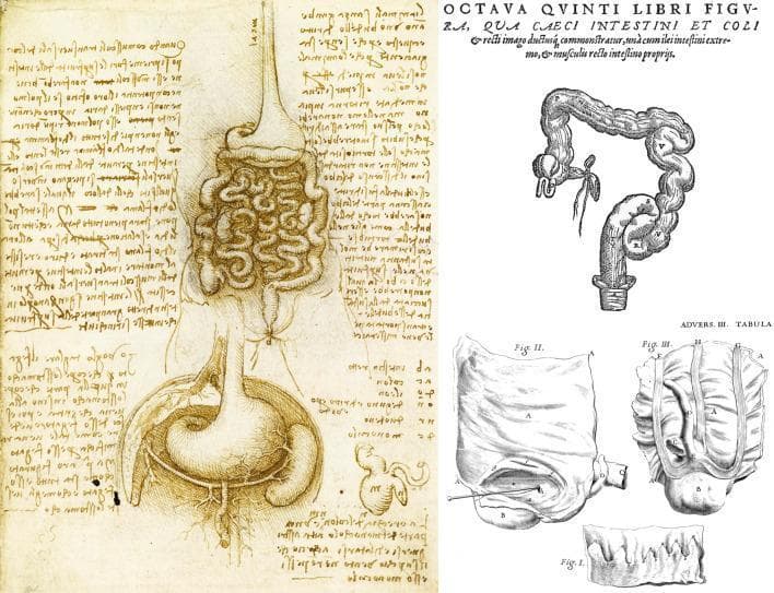 This composite image presents a historical comparison of anatomical drawings focusing on the vermiform appendix and gastrointestinal structures. On the left is a pen-and-ink anatomical diagram by Leonardo da Vinci (c. 1508), depicting the stomach with internal rugae, the esophagus, and the densely coiled small intestines. Below the stomach, a schematic representation of the cecum and appendix is visible, accompanied by mirror-writing notes. The upper right section features a woodcut by Andreas Vesalius showing a more morphologically accurate colon, highlighting the haustra (pouches) and taeniae coli (longitudinal bands), with a clear depiction of the cecum and the vermiform appendix. The lower right contains precise etchings by Giovanni Battista Morgagni, illustrating detailed observational studies of the cecal-appendiceal junction, including variations in appendiceal position and luminal characteristics. These illustrations represent the evolution of anatomical understanding in gastroenterology, moving from schematic representations to detailed structural observations relevant to the history of appendicitis diagnosis and surgical anatomy.