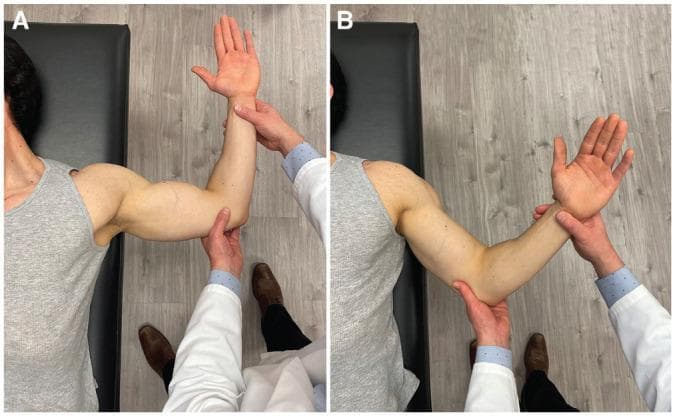 A composite of two clinical photographs (A and B) demonstrating orthopedic physical examination maneuvers for shoulder instability. The patient is positioned supine on an examination table with the scapula stabilized. An examiner in a white coat is shown performing manipulative tests on the right shoulder. View A illustrates the Anterior Apprehension Test (AAT), with the shoulder abducted to 90 degrees and the elbow flexed to 90 degrees while the examiner applies an external rotation force. View B illustrates the Bony Apprehension Test (BAT), where the shoulder is positioned in approximately 45 degrees of abduction and 45 degrees of external rotation. These tests are utilized in clinical sports medicine and orthopedics to assess for glenohumeral instability, specifically evaluating for labral tears or glenoid bone loss. The objective is to identify a positive 'apprehension' sign, indicating symptomatic instability in specific ranges of motion.