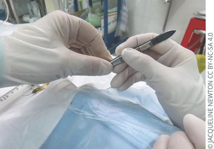 An intraoperative clinical photograph demonstrating the proper technique for passing a sharp surgical instrument between medical personnel. The image shows two pairs of hands wearing white sterile surgical gloves over a sterile surgical field. On the left, a scrub technician or nurse holds a scalpel consisting of a metallic Bard-Parker handle and a sharp surgical blade. The technician grasps the dull, superior edge of the blade, leaving the ridged grip section of the handle completely unobstructed. On the right, the surgeon's hand is shown reaching to grasp the available handle section. This visual illustrates key perioperative safety protocols designed to prevent accidental needle-stick or sharp injuries and ensure the surgeon can immediately establish a functional grip on the tool. The background includes blue sterile draping and other surgical supplies, emphasizing a clinical environment focused on patient safety and procedural efficiency.