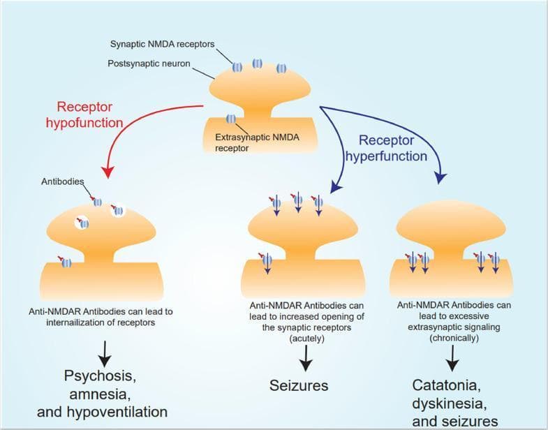 A pathophysiology diagram illustrating the cellular mechanisms and clinical manifestations of anti-NMDA receptor (NMDAr) encephalitis at the postsynaptic neuron. The illustration is divided into two primary pathological pathways: Receptor hypofunction and Receptor hyperfunction. Under 'Receptor hypofunction,' anti-NMDAR antibodies bind to synaptic NMDA receptors, leading to their internalization; this process is linked to symptoms including psychosis, amnesia, and hypoventilation. Under 'Receptor hyperfunction,' two temporal scenarios are presented: an acute phase where antibodies increase the opening of synaptic receptors, leading to seizures, and a chronic phase characterized by excessive extrasynaptic signaling, resulting in catatonia, dyskinesia, and seizures. The diagram demonstrates the relationship between antibody-mediated receptor modulation (internalization versus hyperactivation) and the diverse neuropsychiatric presentation of autoimmune encephalitis.