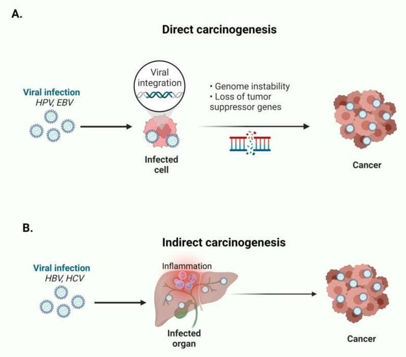 A pathophysiology diagram illustrating two distinct mechanisms of viral-induced oncogenesis. Panel A, titled 'Direct carcinogenesis,' depicts the process for viruses like HPV and EBV. It shows viral particles infecting a cell, followed by 'Viral integration' into the host genome. This leads to molecular consequences including 'Genome instability' and 'Loss of tumor suppressor genes' (visualized by a damaged chromosome icon), ultimately resulting in a cluster of neoplastic cells labeled 'Cancer.' Panel B, titled 'Indirect carcinogenesis,' shows the pathway for HBV and HCV. Here, the viral infection targets an 'Infected organ' (illustrated as a liver), which triggers a state of chronic 'Inflammation.' This inflammatory microenvironment is depicted as the driver that subsequently leads to the 'Cancer' phenotype. The diagram summarizes how different viral etiologies utilize either intracellular genetic disruption or organ-level inflammatory processes to achieve malignant transformation, serving as an educational resource for medical oncology and microbiology.