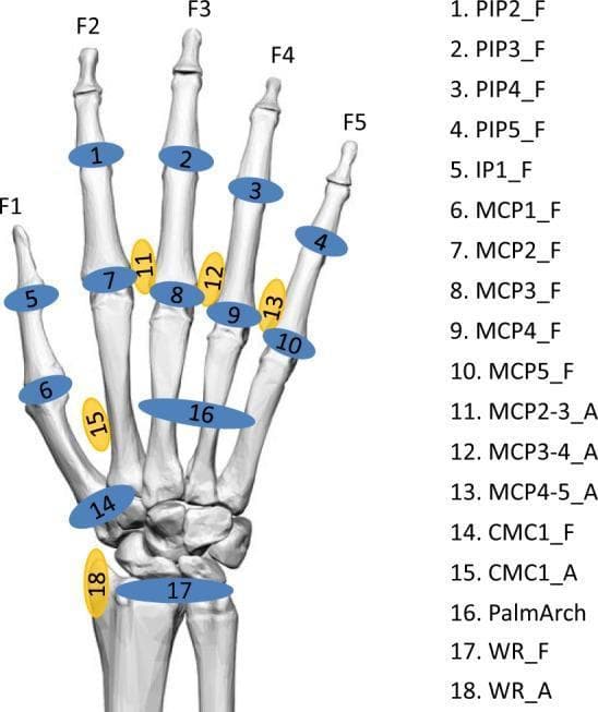 This anatomical diagram displays a skeletal model of the human hand and wrist, serving as a biomechanical reference for recorded anatomical angles. The illustration uses a color-coded numbering system to identify specific joint movements across the digits (F1-F5) and carpus. Blue markers represent flexion (_F), while yellow markers represent abduction (_A). The labeled joints include: the distal and proximal interphalangeal joints (IP1, PIP2-5), the metacarpophalangeal joints (MCP1-5), the carpometacarpal joint of the thumb (CMC1), the palmar arch (PalmArch), and the wrist (WR). Specifically, it identifies flexion for all major finger joints and abduction for the inter-metacarpal spaces (MCP2-3, 3-4, 4-5), the thumb (CMC1_A), and the wrist (WR_A). This diagram is intended for clinical study and biomechanical research, providing a standardized nomenclature for range of motion (ROM) tracking and orthopedic assessment of hand kinematics.