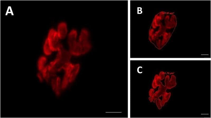 This composite diagnostic image features three panels (A, B, C) showcasing fluorescence microscopy of a mammalian motor endplate at 800x magnification. The primary staining utilizes rhodamine-conjugated alpha-bungarotoxin to visualize the distribution of acetylcholine receptors (AChR) in the postsynaptic compartment. Panel A shows the raw fluorescence signal, revealing a characteristic irregular, clustered morphology of the receptor groups with interspersed dark, non-stained areas. Panel B demonstrates the 'total area' and 'total perimeter' measurement technique, where a red border encompasses the entire synaptic territory, including both receptor clusters and internal gaps (measuring 541.47 µm²). Panel C illustrates the 'stained area' measurement, where the perimeter strictly traces only the fluorescently labeled regions (measuring 251.78 µm²). These images serve as a methodological example for quantifying synaptic plasticity, endplate dispersion, and neuromuscular junction health in neurobiology and clinical physiology research.