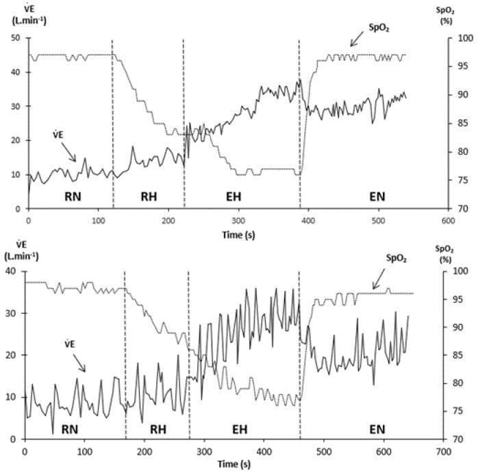 This physiological comparison chart displays breath-by-breath recordings of minute ventilation (VșE, L/min) and pulse oxygen saturation (SpO2, %) during a hypoxia exercise test across four phases: Resting Normoxia (RN), Resting Hypoxia (RH), Exercise Hypoxia (EH), and Exercise Normoxia (EN). The upper panel represents a subject with a high hypoxic ventilatory response (HVRe), while the lower panel shows a subject with a low HVRe. Both subjects exhibit a sharp decline in SpO2 during RH and EH, which recovers in the EN phase. The key educational focus is the respiratory stability difference during the EH phase: the high HVRe subject maintains a relatively stable, increasing VșE trend, whereas the low HVRe subject demonstrates pronounced periodic breathing, characterized by high-amplitude oscillations in minute ventilation and corresponding fluctuations in SpO2. These data illustrate the role of peripheral chemosensitivity in maintaining ventilatory stability under hypoxic stress and exercise conditions, relevant for studies in exercise physiology and high-altitude medicine.