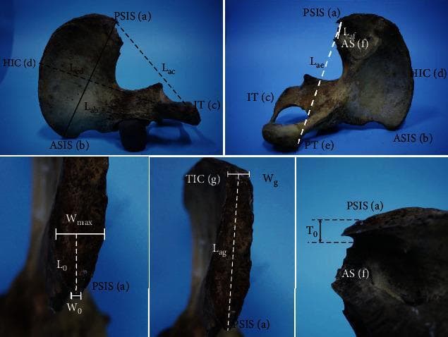 Educational anatomical diagram set showing morphometric measurements of the human hip bone (os coxae). The top two panels demonstrate lateral and medial views of the ilium and ischium, identifying key landmarks including the Posterior Superior Iliac Spine (PSIS), Anterior Superior Iliac Spine (ASIS), Ischial Tuberosity (IT), Highest point of the Iliac Crest (HIC), Pubic Tuberosity (PT), and the Auricular Surface (AS). Linear measurements shown (Lab, Lcd, Lac, Lae, Laf) define the spatial relationships between these landmarks for skeletal analysis. The bottom three panels provide high-magnification views specifically focused on the PSIS morphology. These detailed frames illustrate measurements for surgical and forensic relevance, including the tip width (W0), maximum width (Wmax), tip thickness (T0), and the distance to the Transition of the Iliac Crest (TIC). The content is designed for orthopaedic, forensic, and anatomical education, illustrating the standardized methodology for quantifying pelvic skeletal variation and point-of-interest dimensions.