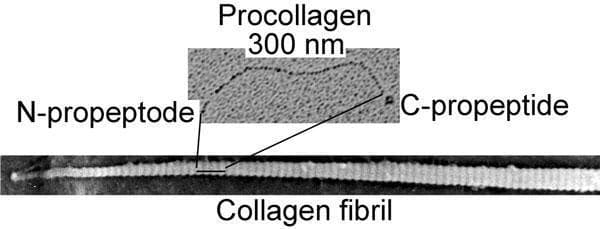 This diagnostic image consists of two electron microscopy (EM) micrographs displaying the ultrastructure of human collagen at different stages of assembly. The top micrograph shows a single procollagen molecule, approximately 300 nm in length. It features a tripartite morphology with a central, wavy triple-helical domain flanked by globular extensions identified as the N-propeptide and C-propeptide. The bottom micrograph illustrates a larger, self-assembled collagen fibril. This mature structure exhibits characteristic periodic striations, appearing as alternating dark and light bands along its longitudinal axis. This visual comparison demonstrates the structural transition from a precursor procollagen molecule to a densely packed, organized collagen fibril following the enzymatic cleavage of the terminal propeptides. The image serves as an educational tool for molecular biology and histology, illustrating the fundamental protein components of connective tissues such as skin, bone, and tendon.