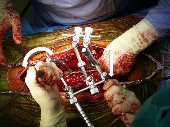 Hugging Face pmc clinical VQA raw