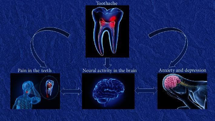 A pathophysiology diagram illustrating the multidirectional relationship between dental pain and neuropsychological states. The schematic follows a cyclical flow starting with 'Toothache', represented by a molar illustration with pulpal inflammation. A downward arrow connects this to 'Neural activity in the brain', depicted by a 3D model of the human brain. This central node is connected via double-headed horizontal arrows to two auxiliary states: 'Pain in the teeth' (visualized by a patient in distress with local dental inflammation) and 'Anxiety and depression' (visualized by a person holding their head with the brain highlighted). Curved arrows further link 'Toothache' to 'Pain in the teeth' and 'Anxiety and depression' back to 'Toothache', establishing a feedback loop. This educational visual demonstrates how chronic dental pain (odontalgia) triggers cerebral functional connectivity changes, which in turn correlate with mood disorders like anxiety and depression, potentially exacerbating the perception of pain.