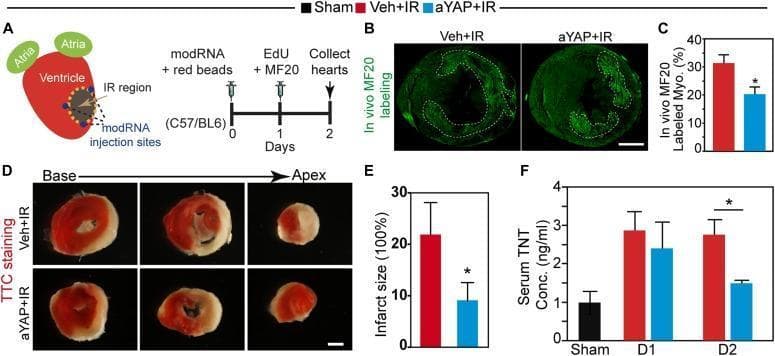 This composite educational image details a preclinical study on myocardial ischemia-reperfusion (IR) injury and the cardioprotective effects of active YAP (aYAP) modified RNA (modRNA).
Panel A illustrates the experimental design: LAD ligation followed by modRNA and red bead injection, with subsequent histological collection. Panel B presents fluorescence microscopy of heart cross-sections with in vivo MF20 labeling (green), a marker for necrotic cardiomyocytes. The vehicle control (Veh+IR) shows significantly more extensive green fluorescence compared to the aYAP+IR group, which is quantified in Panel C as a reduced percentage of MF20-labeled myocardium.
Panel D shows Triphenyltetrazolium chloride (TTC) staining of heart slices from base to apex. Viable tissue stains red, while infarcted tissue appears pale/white. The aYAP+IR group demonstrates visibly smaller infarct zones across all levels compared to the Veh+IR group. This is quantified in Panel E, showing a significant reduction in infarct size. Panel F displays a bar graph of serum cardiac Troponin T (cTnT) concentrations, indicating lower levels in the aYAP-treated group at Day 2, reflecting reduced myocardial damage. The content demonstrates pathophysiology, therapeutic intervention, and diagnostic biomarkers of myocardial infarction.