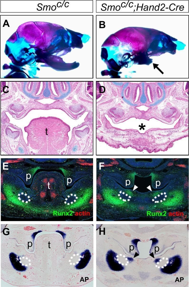 This composite image presents a comparative developmental study of craniofacial morphogenesis in mouse embryos, focusing on the Smoc/c control (left) versus Smoc/c;Hand2-Cre mutants (right). (A-B) Whole-mount skeletal preparations stained with Alizarin Red and Alcian Blue show lateral views of the head. The mutant (B) exhibits significant mandibular hypoplasia (arrow) while the cranium remains intact. (C-D) H&E-stained frontal sections at E16.5 demonstrate complete tongue agenesis (asterisk) in the mutant compared to the well-developed tongue ('t') in the control. (E-F) Immunofluorescence staining for Runx2 (green) and muscle alpha-actin (red) at E12.5 reveals ectopic ossification (arrowheads) in the mutant's oral mandibular region and absence of tongue musculature. Dashed lines delineate the Meckel’s cartilage primordia. (G-H) Alkaline phosphatase (AP) activity staining (blue) confirms this ectopic ossification in the oral mesenchyme of the mutant (H, arrowheads). This panel illustrates the role of hedgehog signaling in patterning the oral-aboral axis of the mandible and tongue development, demonstrating that disruption leads to mandibular truncation and tongue agenesis.