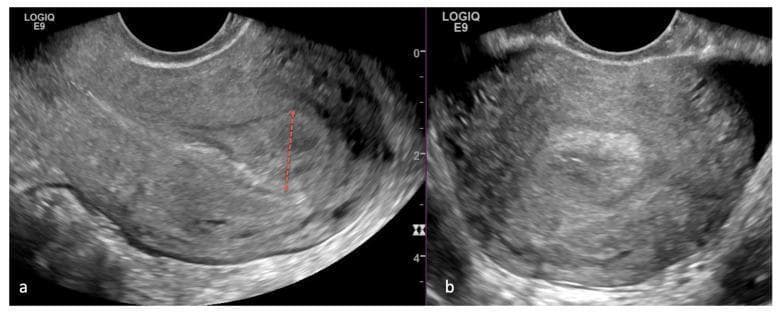 Hugging Face pmc clinical VQA raw