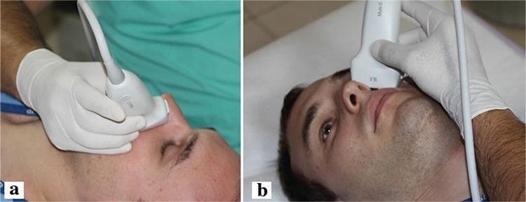 This clinical photograph consists of two panels (a and b) demonstrating the technique for performing ultrasound elastography of the lateral nasal wall. A patient is shown in a supine position while a radiologist, wearing protective medical gloves, applies a high-frequency linear ultrasound probe to the external lateral aspect of the nose. Panel 'a' provides a lateral profile view, showing the probe's contact point relative to the nasal bridge and cheek. Panel 'b' offers a superior-frontal perspective, illustrating the precise placement of the transducer over the area corresponding to the internal nasal turbinates. The procedure is used to measure tissue stiffness via the propagation speed of sound waves (m/s), which serves as a diagnostic tool in assessing conditions such as allergic rhinitis (AR). This visual serves as an educational guide for standardized probe positioning in rhinology-focused ultrasound imaging and elastographic evaluation of nasal mucosa.