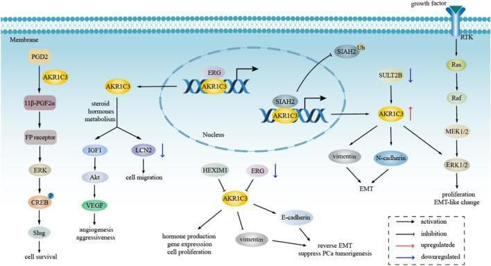 A pathophysiology diagram illustrating the intracellular signaling pathways of AKR1C3 in the context of cancer progression, specifically hormone-dependent tumors like prostate cancer. The diagram maps several concurrent pathways: 1) A growth factor-induced Receptor Tyrosine Kinase (RTK) pathway activating the Ras/Raf/MEK/ERK cascade leading to proliferation and EMT-like changes. 2) Prostaglandin metabolism where AKR1C3 converts PGD2 to 11β-PGF2α, signaling through the FP receptor/ERK/CREB/Slug axis to promote cell survival. 3) Steroid hormone metabolism where AKR1C3 influences IGF1/Akt/VEGF for angiogenesis and LCN2 for cell migration. 4) Nuclear interactions where AKR1C3 complexes with ERG and SIAH2 to modulate gene expression. 5) Cytoplasmic regulation where AKR1C3 upregulates vimentin and N-cadherin (promoting EMT) or downregulates E-cadherin to affect PCa tumorigenesis. The visual uses arrows to denote activation, T-bars for inhibition, and color-coded arrows for up/down-regulation, highlighting AKR1C3 as a central mediator of oncogenic signaling, epithelial-mesenchymal transition, and therapeutic resistance.