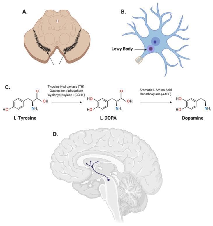 Educational infographic illustrating the neuro-pathophysiology of Parkinson's Disease (PD) through four distinct panels. Panel A displays a cross-sectional anatomical diagram of the midbrain, highlighting the bilateral, arc-shaped dark regions of the substantia nigra pars compacta. Panel B shows a schematic of a dopaminergic neuron containing a prominent intracellular Lewy Body, characterized as a dense, circular proteinaceous inclusion within the cell body. Panel C presents a biochemical flowchart of dopamine synthesis, detailing the enzymatic conversion of L-Tyrosine to L-DOPA via tyrosine hydroxylase (TH) and GCH1, followed by decarboxylation to Dopamine by aromatic L-amino acid decarboxylase (AADC). Panel D provides a sagittal view of the human brain, illustrating the nigrostriatal pathway where neurons from the substantia nigra project to the striatum within the basal ganglia. This combined visual explores the relationship between gross anatomical changes, cellular proteinopathy, neurotransmitter biochemistry, and neural circuit dysfunction in the progression of PD.