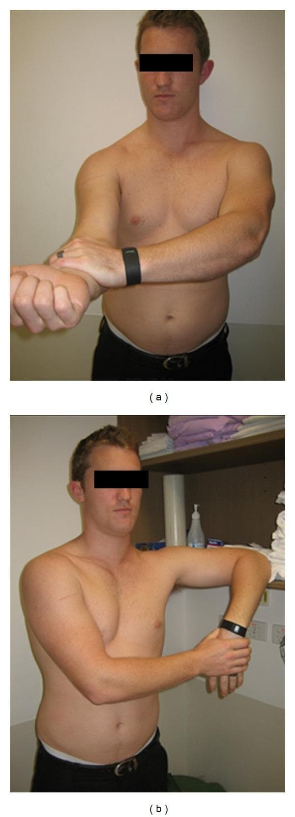 Clinical photograph showing two specific orthopedic physical examination maneuvers performed for shoulder pathology. Image (a) demonstrates Speed's test, which evaluates the long head of the biceps tendon; the participant has the right arm extended anteriorly with the forearm supinated, while the left hand applies downward resistance at the distal forearm/wrist. Image (b) illustrates a modification of the Hawkins-Kennedy impingement test, used to assess for subacromial impingement; the participant's right arm is flexed to 90 degrees at the shoulder with the elbow also flexed to 90 degrees, and the arm is internally rotated. These images represent telerehabilitation or self-administered physical examination techniques where the patient uses their own limbs or surrounding environment to recreate provocative orthopedic tests. The anatomical focus is the glenohumeral joint and associated musculotendinous structures. Educational context includes musculoskeletal assessment, physical therapy, and telemedicine clinical reasoning.