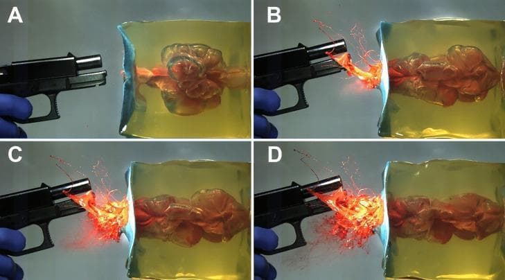 A series of four high-speed photographic frames (A-D) demonstrating the terminal ballistics of a 9 mm Luger shot into a gelatin block at a 1 cm distance, used as a human tissue surrogate in forensic pathology. Panel A (7.2 ms) shows the re-expansion phase of the temporary cavity (TC) following its initial collapse; the cavity appears irregular and multi-lobulated within the transparent gelatin. Panels B (12.5 ms), C (13.3 ms), and D (14.2 ms) illustrate the progression of backspatter. In B, a distinct linear jet of orange-colored fluid (simulated blood/tissue) is ejected from the entry wound toward the firearm muzzle. By C and D, escaping muzzle gases transform this linear jet into a wider, more chaotic spray and aerosol-like pattern with increasing dispersion of droplets. This sequence illustrates the pathophysiology of backspatter formation and the influence of muzzle gases on retrograde material ejection in near-contact gunshot wounds, which is critical for forensic reconstruction and clinical assessment of firearm injuries.