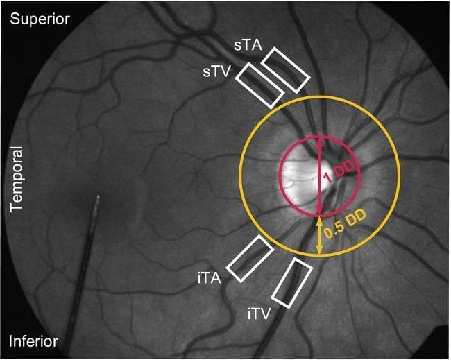 This monochrome fundus photograph depicts the retinal anatomy of a healthy subject during Dynamic Vessel Analysis (DVA). The optic disc is centrally located on the right side of the frame, with two concentric colored circles overlaid to define measurement boundaries: a red circle indicating 1 optic disc diameter (DD) and a gold circle marking a 0.5 DD distance from the disc margin. Four primary retinal vessel segments are highlighted with white rectangular boxes for vessel diameter measurement: the superior temporal artery (sTA) and vein (sTV) in the upper temporal quadrant, and the inferior temporal artery (iTA) and vein (iTV) in the lower temporal quadrant. The labels 'Superior', 'Inferior', and 'Temporal' provide cardinal orientation. The image demonstrates the typical branching morphology of the retinal vasculature, with veins appearing slightly wider and darker than their corresponding arteries. This visual illustrates the protocol for selecting vessel segments at least 0.5 DD from the optic disc to ensure accurate assessment of retinal microvascular reactivity and hemodynamic responses.
