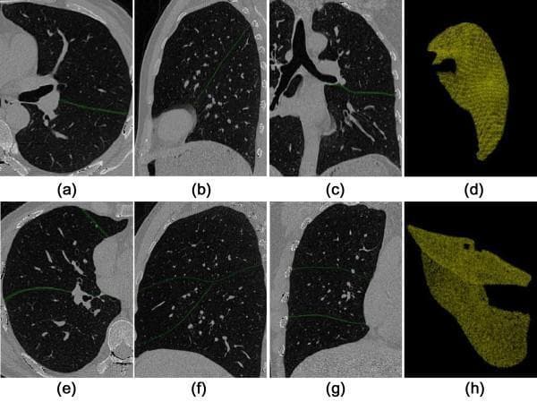This diagnostic imaging composite displays Computerized Tomography (CT) scans and 3D reconstructions focused on pulmonary fissure detection and lung lobe segmentation. The image is organized into two rows: the top row (a-d) illustrates the left lung, and the bottom row (e-h) illustrates the right lung. Panels (a, e) show axial views, (b, f) sagittal views, and (c, g) coronal views. In these 2D slices, pulmonary fissures are highlighted as thin, green curvilinear lines that demarcate the boundaries between the lobes (oblique fissure on the left; oblique and horizontal fissures on the right). Panels (d, h) present 3D volume renderings of the segmented lungs in a yellowish-gold color, showing the anatomical morphology of the lobes and the textured surface resulting from the 3D region-growing extraction method. This visual material demonstrates the application of automated algorithms for identifying lung anatomy and interlobar boundaries, which is critical for surgical planning, nodule localization, and assessing pulmonary pathologies like emphysema.