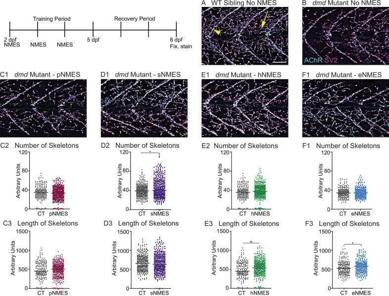 This composite educational image illustrates the effects of various neuromuscular electrical stimulation (NMES) paradigms on neuromuscular junction (NMJ) structure in a zebrafish model of Duchenne muscular dystrophy (dmd). The panel includes fluorescence microscopy images and corresponding quantitative dot plots. The NMJs are visualized using dual staining: anti-SV2 (cyan) for presynaptic terminals and alpha-bungarotoxin (magenta) for postsynaptic acetylcholine receptors (AChR). (A) Wild-type (WT) sibling showing a dense, organized network of innervation. (B) dmd mutant without treatment, displaying significant reduction and fragmentation of NMJ innervation. Panels C1-F1 show dmd mutants treated with four different NMES paradigms: power (pNMES), strength (sNMES), hypertrophy (hNMES), and endurance (eNMES). Accompanying graphs (C2-F3) quantify NMJ morphology using skeletonization analysis. Data indicate that sNMES (D2) primarily increases the number of skeletons (synaptic clusters), while hNMES (E3) and eNMES (F3) significantly increase skeleton length compared to untreated controls, suggesting that specific stimulation protocols can partially restore or improve NMJ stability and architecture in dystrophic muscle.