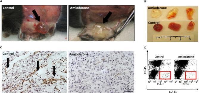 This composite educational figure illustrates the anti-angiogenic effects of Amiodarone using a mouse Matrigel plug assay. Panel A and B present clinical photographs of Matrigel plugs in situ and post-excision. The control group shows deep red, bloody plugs with extensive surrounding vasculature, while the Amiodarone-treated group exhibits pale, translucent plugs with significantly reduced vessel formation. Panel C shows light microscopy images of histological sections (400x magnification) stained with anti-CD31 antibodies (DAB-brown) and Gill’s Hematoxylin (blue nuclei). The control section demonstrates numerous brown-stained vascular structures with open lumens (indicated by arrows), whereas the treated section shows sparse CD31 positivity and a lack of organized vessel architecture. Panel D contains flow cytometry (FACS) dot plots comparing CD31+ / CD45- endothelial cell populations (highlighted in red squares). The plots demonstrate a quantitative reduction in infiltrating endothelial cells in the Amiodarone-treated plugs compared to the untreated control. This image is relevant for studying pharmacological inhibition of angiogenesis and tumor microenvironment modulation.