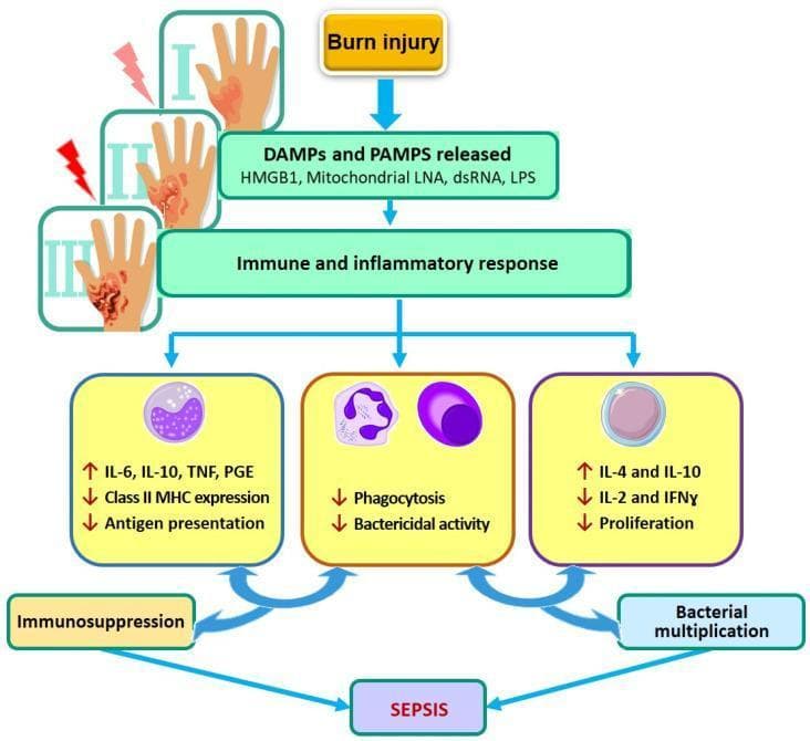 A pathophysiology flow diagram illustrating the immunological cascade from severe burn injury to the development of sepsis. The diagram begins with a burn injury, represented by illustrations of first-, second-, and third-degree burns on a hand, leading to the systemic release of Damage-Associated Molecular Patterns (DAMPs) and Pathogen-Associated Molecular Patterns (PAMPs), specifically citing HMGB1, mitochondrial LNA, dsRNA, and LPS. This initiates a complex immune and inflammatory response characterized by three convergent pathways: 1) Pro-inflammatory and anti-inflammatory cytokine imbalances (increased IL-6, IL-10, TNF, and PGE) alongside reduced Class II MHC expression and antigen presentation, leading to immunosuppression. 2) Impaired innate cellular function, specifically decreased phagocytosis and bactericidal activity. 3) Th2-skewed cytokine shifts (increased IL-4 and IL-10; decreased IL-2 and IFN̲γ) and reduced lymphocyte proliferation, promoting bacterial multiplication. These combined dysregulated host responses ultimately culminate in burn-induced sepsis.