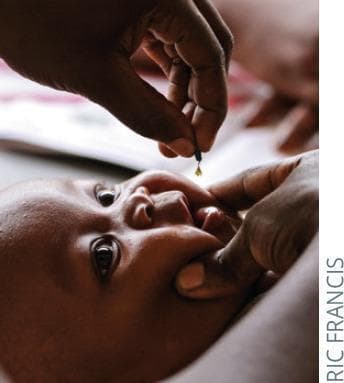 A clinical photograph depicting the oral administration of a medical supplement, specifically Vitamin A, to a four-month-old infant. The infant is positioned supine, with the head slightly elevated and stable. A healthcare worker is shown using their thumb and index finger to gently depress the chin and retract the cheek, ensuring the mouth is sufficiently open for safe delivery. The administrator's other hand holds a small dropper or capsule, from which a single yellow liquid drop is descending into the infant's oral cavity. This visual illustrates a standard public health intervention in pediatrics, aimed at preventing xerophthalmia and reducing child morbidity and mortality associated with vitamin A deficiency in low-income regions. The procedure emphasizes safe manual handling and the technique for oral liquid dosing in infants who cannot yet swallow tablets or coordinate drinking from a cup.
