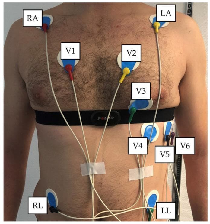 This procedural clinical photograph demonstrates the concurrent placement of a standard 12-lead electrocardiogram (ECG) and a Polar H10 heart rate sensor chest strap on a male subject. The image illustrates proper anatomical positioning for clinical and exercise physiology monitoring. The six precordial leads (V1-V6) are visible across the chest: V1 (4th intercostal space, right sternal border), V2 (4th intercostal space, left sternal border), V3 (midway between V2 and V4), V4 (5th intercostal space, mid-clavicular line), V5 (anterior axillary line), and V6 (mid-axillary line). The leads utilize standard color-coding (Red, Yellow, Green, Brown, Black, Violet). Limb leads are positioned at the shoulders (RA/LA) and the lower ribcage/abdominal area (RL/LL) to facilitate movement during testing. The Polar H10 chest strap is situated inferior to the pectoral muscles, intersecting the mid-precordial electrode line. This visual serves as an educational reference for electrode application in comparative heart rate variability (HRV) studies, highlighting the spatial relationship between traditional medical grade ECG sensors and wearable consumer fitness technology.
