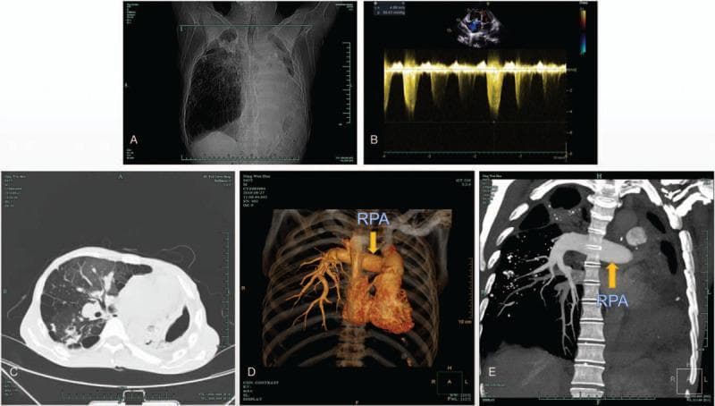 Hugging Face pmc clinical VQA raw