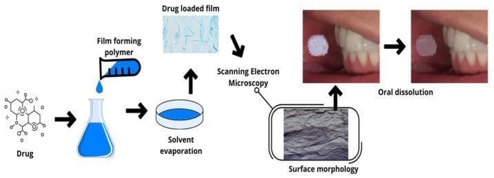 This educational diagram illustrates the pharmaceutical manufacturing and clinical application of a mucoadhesive oral drug-loaded film. The flowchart begins with the synthesis process, where a chemical drug molecule is combined with a 'film forming polymer' in a liquid solution. This is followed by 'solvent evaporation' in a casting dish, resulting in a 'drug loaded film' shown in a light-blue microscopic view with needle-like drug structures. Characterization is demonstrated through 'Scanning Electron Microscopy' (SEM), providing a high-magnification view of the film's surface morphology. The clinical sequence features two intraoral clinical photographs showing a circular white film applied to the buccal mucosa adjacent to the lower molars. The 'oral dissolution' phase depicts the gradual degradation and size reduction of the film over time in the oral cavity. This schematic is designed to teach the solvent casting technique and the mechanism of transmucosal drug delivery for oral healthcare applications.