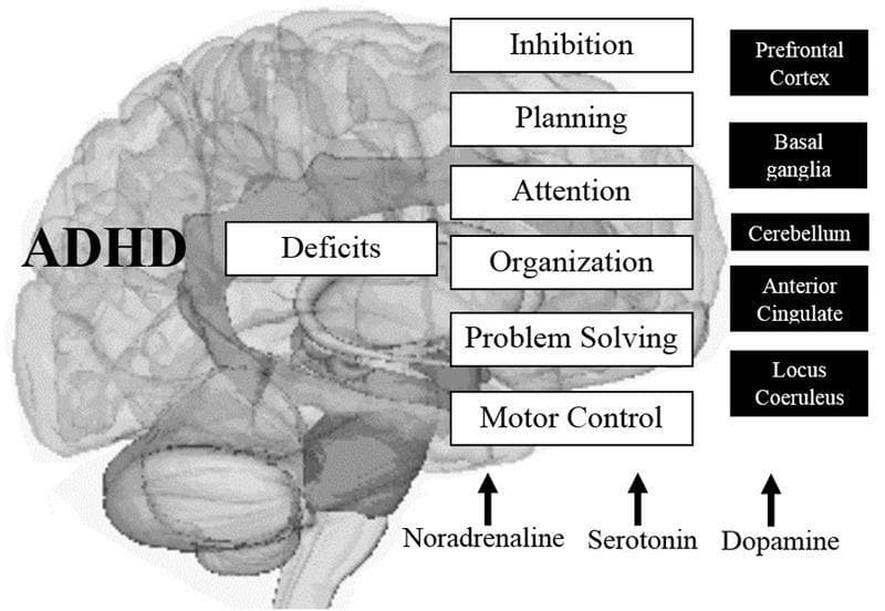 This medical infographic illustrates the neurobiological basis of Attention-Deficit/Hyperactivity Disorder (ADHD) by mapping cognitive deficits to specific neuroanatomical structures and neurotransmitter systems. The central visual is a translucent sagittal-view diagram of the human brain. Labeled 'ADHD' and 'Deficits,' the diagram connects executive function impairments—including inhibition, planning, attention, organization, problem-solving, and motor control—to a highlight of the prefrontal-striatal-cerebellar circuitry. Key anatomical regions identified as involved in the pathophysiology include the Prefrontal Cortex, Basal Ganglia, Cerebellum, Anterior Cingulate, and Locus Coeruleus. At the base of the diagram, the catecholamine and monoamine pathways are represented through labels for Noradrenaline, Serotonin, and Dopamine, indicating their role in modulating these cognitive processes. This educational visualization demonstrates the multi-regional and neurochemical complexity of ADHD, emphasizing how structural and biochemical alterations manifest as clinical deficits in executive functioning. It is designed for clinical neurobiology education and diagnostic conceptualization.