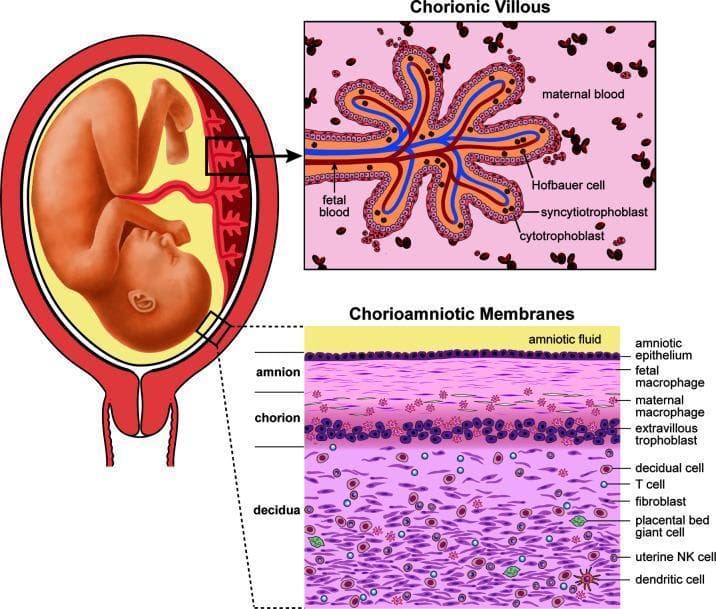 This medical illustration details the human placental anatomy and maternal-fetal interface across three views. On the left, a macro-level diagram shows a fetus in utero with the umbilical cord and placental attachment. Two inset panels provide microscopic structural detail. The upper right panel displays a cross-section of a Chorionic Villous, illustrating the exchange interface where fetal blood vessels are separated from the maternal blood space by three distinct layers: the syncytiotrophoblast, cytotrophoblast, and underlying stroma containing Hofbauer cells (placental macrophages). The lower right panel illustrates the layered Chorioamniotic Membranes. From the amniotic fluid inward, the layers are identified as the amniotic epithelium, the amnion (containing fetal macrophages), the chorion (containing maternal macrophages and extravillous trophoblasts), and the maternal decidua. The decidual layer is shown to be rich in diverse immune and stromal cells, including T cells, fibroblasts, placental bed giant cells, uterine Natural Killer (NK) cells, and dendritic cells. The diagram serves as an educational tool for understanding placental barrier composition and immune cell distribution at the maternal-fetal interface.