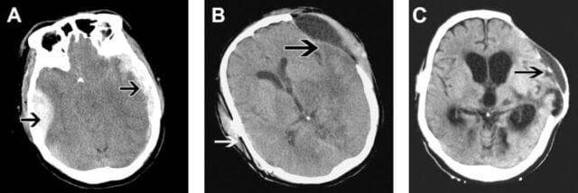 Hugging Face pmc clinical VQA raw