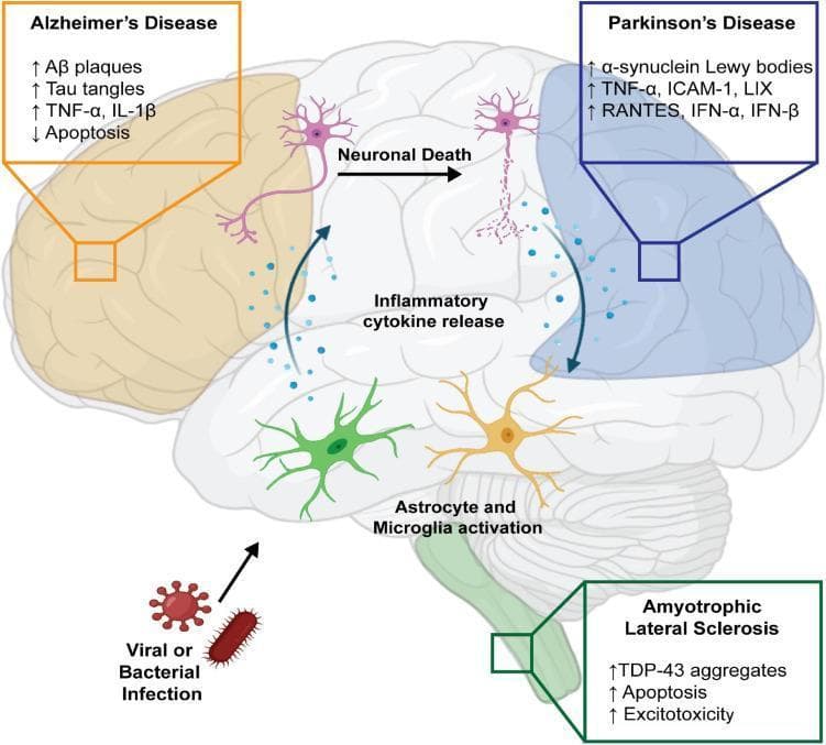 A pathophysiology diagram illustrating the relationship between infectious agents and neurodegenerative diseases within the central nervous system. The illustration depicts a sagittal view of the human brain with three highlighted regions corresponding to Alzheimer's Disease (orange), Parkinson's Disease (blue), and Amyotrophic Lateral Sclerosis (ALS, green). The flowchart begins with 'Viral or Bacterial Infection' entering the CNS, triggering 'Astrocyte and Microglia activation.' This lead to 'Inflammatory cytokine release' and ultimately 'Neuronal Death.' Detailed call-out boxes list molecular hallmarks for each condition: Alzheimer's shows increased Aβ plaques, Tau tangles, and TNF-α/IL-1β; Parkinson's shows increased α-synuclein Lewy bodies and various cytokines (TNF-α, RANTES, IFN); ALS shows increased TDP-43 aggregates, apoptosis, and excitotoxicity. The diagram emphasizes the role of neuroinflammation and glial cell immune responses in the progression of proteinopathies and neuronal loss across different neurological disorders.