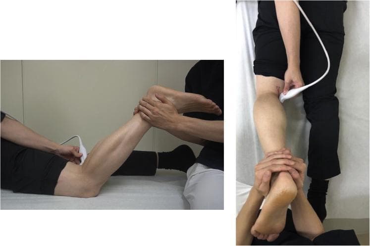 This procedural clinical photograph demonstrates the specific patient and clinician positioning for a dynamic musculoskeletal ultrasound evaluation of the posterior knee, particularly for identifying medial meniscus ramp lesions. The image consists of two views: a lateral profile and a superior posterior view. The patient is positioned prone on an examination table. The target knee is flexed to approximately 70 degrees, with an assistant manually supporting the lower leg and foot to facilitate isometric contraction during the scan. A linear ultrasound transducer is applied to the posterior aspect of the knee, specifically targeting the medial side of the popliteal fossa above the semitendinosus and semimembranosus tendons. The examiner holds the probe firmly against the skin to maintain a stable view of the deep joint structures while the patient performs resisted knee flexion. This technique is designed to visualize dynamic changes in the joint capsule and meniscus, such as the 'meniscus left behind' sign.