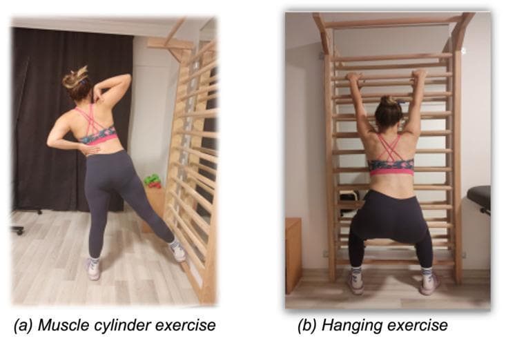 Two clinical photographs demonstrating corrective physical therapy exercises for scoliosis management, specifically within the Schroth Best Practice approach. (a) Muscle Cylinder Exercise: A patient is shown in a standing position with the torso rotated. One leg is extended laterally toward a stall bar (wall ladder), and one hand is placed on the lumbar region to provide tactile feedback or support. This exercise aims to activate intrinsic back musculature and achieve multi-planar spinal correction (frontal, sagittal, and horizontal). (b) Hanging Exercise: The patient is seen from the posterior view, suspended from a stall bar with arms extended overhead. The knees are flexed and the body is aligned vertically. This modality focuses on spinal elongation and mobilization, particularly relevant for severe scoliotic curves where thoracic gibbosity is present. Both images serve as educational demonstrations of rehabilitation techniques used to modify the Angle of Trunk Rotation (ATR) and manage spinal curvature in orthopedic and physical therapy contexts.
