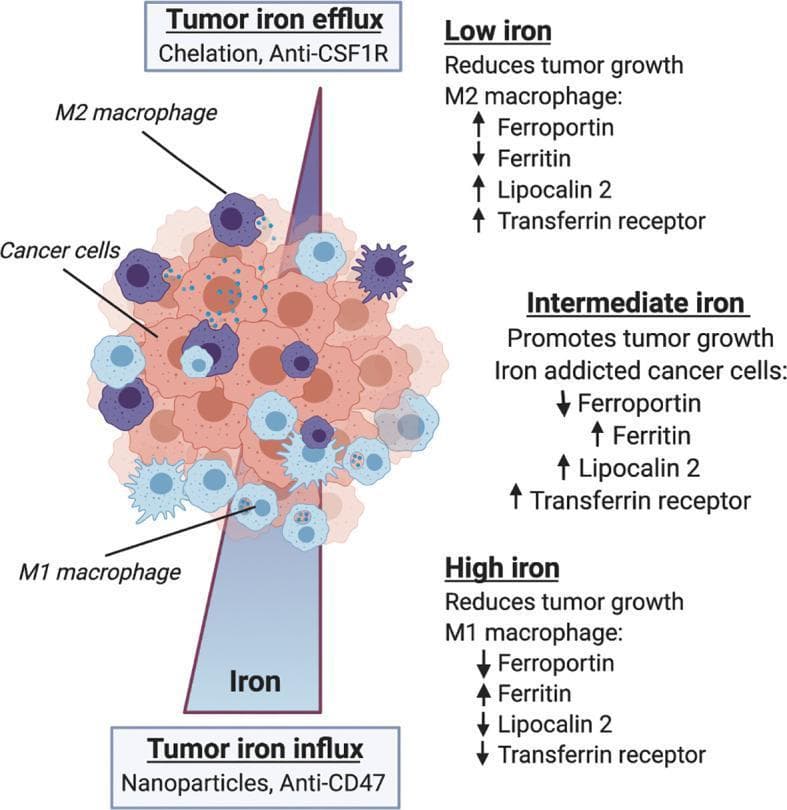 This pathophysiology diagram illustrates the relationship between iron metabolism, macrophage polarization, and tumor growth within the tumor microenvironment (TME). A central cellular cluster depicts cancer cells (light orange), M1 macrophages (light blue, smooth), and M2 macrophages (purple, spiky). A vertical gradient represents iron concentration, influenced by 'Tumor iron influx' (bottom, associated with nanoparticles and anti-CD47) and 'Tumor iron efflux' (top, associated with chelation and anti-CSF1R). The diagram categorizes the TME into three metabolic regimes. 1) Low iron: favors M2 macrophages, characterized by increased ferroportin, lipocalin 2, and transferrin receptor but reduced ferritin, leading to reduced tumor growth. 2) Intermediate iron: characterized by 'iron-addicted' cancer cells with low ferroportin and high levels of ferritin, lipocalin 2, and transferrin receptor, which promotes tumor growth. 3) High iron: favors M1 macrophages, characterized by increased ferritin and reduced ferroportin, lipocalin 2, and transferrin receptor, resulting in reduced tumor growth. This educational infographic demonstrates how iron availability modulates immune cell phenotype and clinical outcomes in oncology.