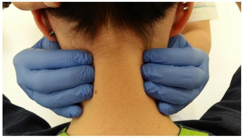 A procedural clinical photograph demonstrating the palpation of the posterior neck muscles, specifically the upper trapezius, splenius cervicis, and levator scapulae. The image is taken from a posterior view of the patient's head and neck. An examiner, wearing blue nitrile gloves, is shown with hands positioned symmetrically on both sides of the patient’s cervical region. The examiner’s fingers are gripping the muscular bulk lateral to the cervical spine, while the thumbs are likely positioned anteriorly to provide stabilization. Key anatomical landmarks visible include the occipital base, the auricles (ears), and the posterior cervical midline. This clinical maneuver is used to assess for muscle tension, trigger points, tenderness, or structural abnormalities often associated with temporomandibular disorders (TMD) or cervicalgia. The procedure illustrates a standardized physical examination technique for evaluating referred pain or compensatory muscle strain in the masticatory and cervical systems.