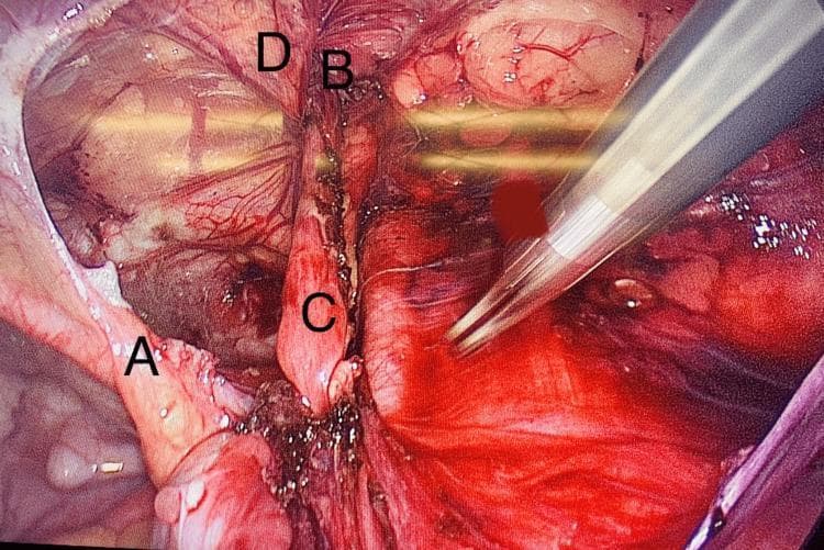 Hugging Face pmc clinical VQA raw