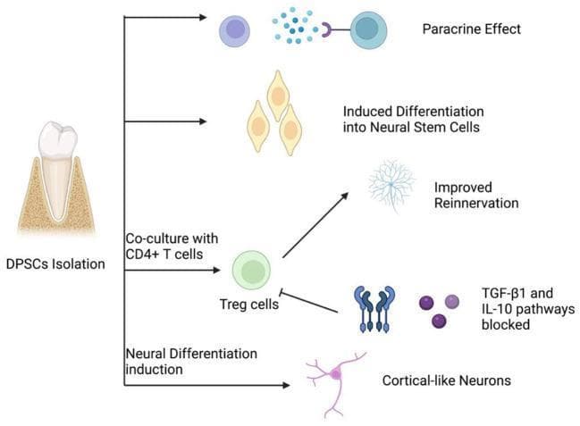 This medical pathophysiology diagram illustrates the regenerative mechanisms of Dental Pulp Stem Cells (DPSCs) in peripheral nerve repair. The flowchart begins on the left with 'DPSCs Isolation' from a human tooth, branching into four primary therapeutic pathways. 1) Paracrine Effect: Depicted by DPSCs secreting signaling molecules (blue spheres) that interact with target cell receptors. 2) Induced Differentiation into Neural Stem Cells: Shows DPSCs transforming into elongated, teardrop-shaped neural progenitor cells. 3) Immunomodulatory Pathway: Describes the co-culture of DPSCs with CD4+ T cells to produce Regulatory T cells (Treg cells), which promotes 'Improved Reinnervation' (visualized as a complex neuronal network) or blocks TGF-̢1 and IL-10 pathways to modulate the inflammatory environment. 4) Neural Differentiation Induction: Shows the direct maturation of DPSCs into 'Cortical-like Neurons' characterized by a distinct soma and branching processes. This diagram serves as a pedagogical summary of biotherapy and neuroregeneration concepts within regenerative medicine.