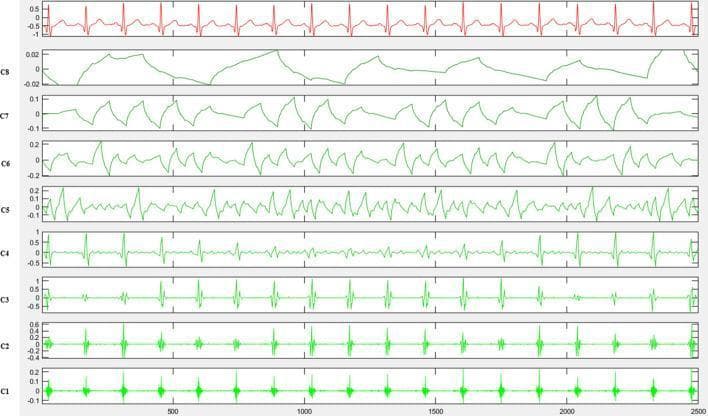 This diagnostic image illustrates the Empirical Mode Decomposition (EMD) of a resting human electrocardiogram (ECG) signal. The topmost waveform, shown in red, represents the original 10-second ECG recording sampled at 250 Hz, clearly displaying rhythmic P waves, QRS complexes, and T waves characteristic of normal sinus rhythm in a stable patient. Below the raw signal are eight decomposed intrinsic mode functions, labeled C1 through C8 in green. The series demonstrates a frequency gradient: the bottom components (C1-C3) capture high-frequency oscillations corresponding to the sharp deflections of the QRS complex, while the middle components (C4-C6) represent the superposition of the P, QRS, and T waves and the overall cardiac rhythm. The topmost decomposed components (C7-C8) isolate low-frequency elements and cardiac physiological adjustment rhythms on a long-term scale. This visualization is used in clinical research to analyze myocardial electrical energy (RT index) for differentiating between coronary stenosis severities and identifying myocardial ischemia.
