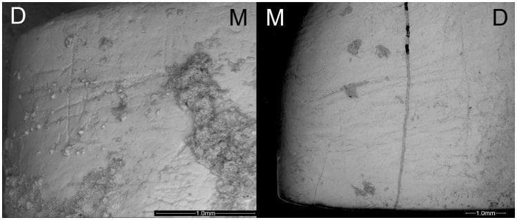 This diagnostic microscopy image displays two high-magnification views of human dental specimens (LI2 and LI1) highlighting instrumental striations from an archaeological context. The left panel shows an upper lateral incisor (LI2) with clear, fine linear grooves etched into the labial surface, predominantly in oblique and horizontal orientations. Clusters of granular sediment deposits are visible on the mesial (M) aspect, partially obscuring the enamel surface. The right panel displays an upper central incisor (LI1) with similar linear striations across the labial face, including a prominent vertical crack or post-depositional feature near the midline. Both specimens are marked with 'M' (mesial) and 'D' (distal) to indicate anatomical orientation. The image demonstrates cultural dental wear patterns, specifically 'stuff-and-cut' striations associated with non-masticatory use of teeth in prehistoric populations. The well-preserved surface morphology facilitates the study of manual laterality and dental biomechanics in paleoanthropology and forensic odontology. Scale bars of 1.0mm are provided for both frames.
