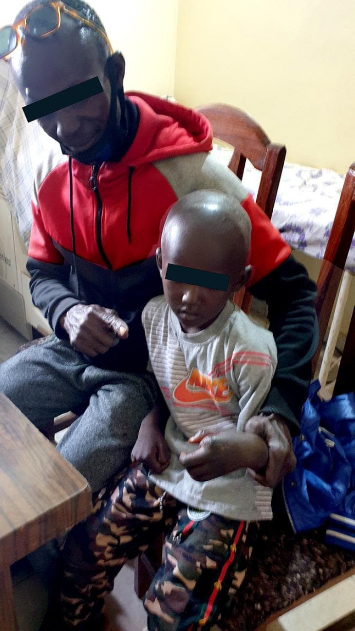Clinical photograph documenting the 'Guérison' (recovery) phase of a pediatric patient following severe snakebite envenomation. The image shows a young child of African descent seated with an adult, illustrating the long-term clinical outcome after intensive medical intervention. The child's left hand, which previously underwent a surgical amputation of the index finger due to necrotic complications (gas gangrene and grade 3 edema), is visible. The hand appears healed with significant functional and aesthetic sequelae resulting from the venom-induced local tissue necrosis and subsequent surgical management. The photograph serves as a medical case study of successful recovery from a life-threatening ophidian accident involving coagulopathy and severe local infection, highlighting the result of combined treatment with polyvalent antivenom, surgical debridement/amputation, and broad-spectrum antibiotic therapy.